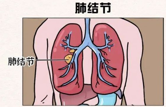 17043571972762.png 1.png