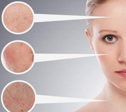 17053098092492.png 1.png