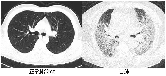 17053951236597.png 1.png